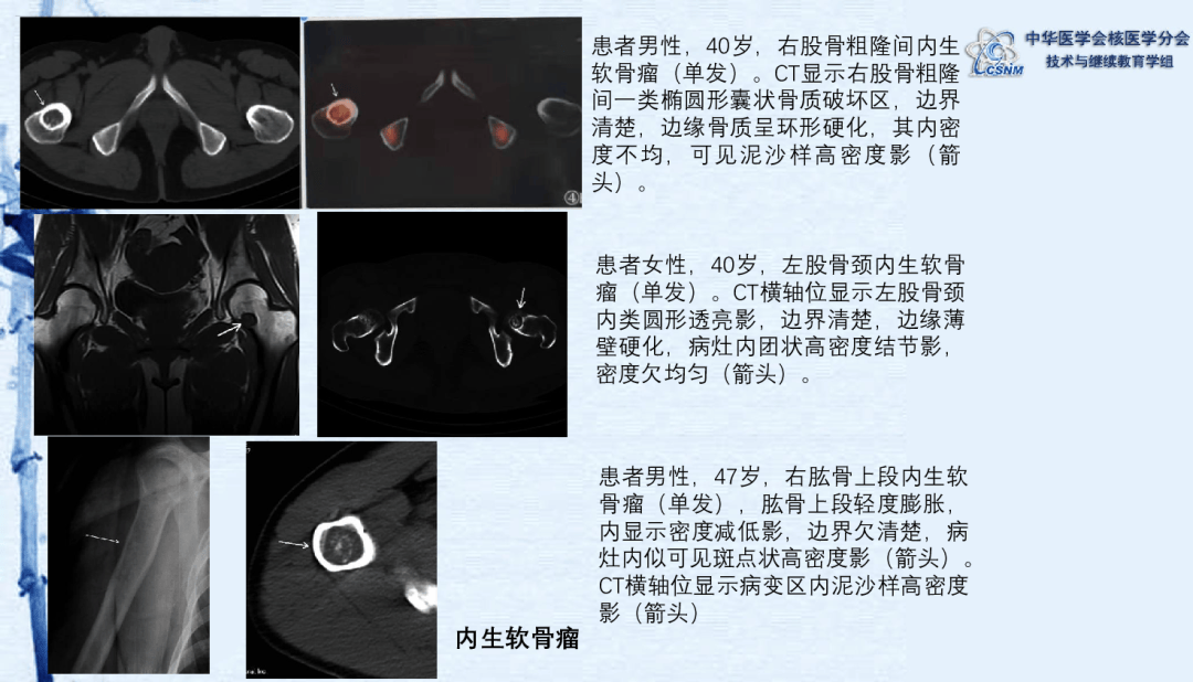 spect与pet区别 spect和pet的优缺点 